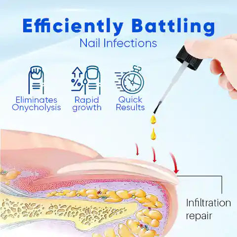 SUERO REPARADOR DE UÑAS