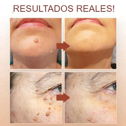 TONICO CHAO VERRUGAS 2x1
